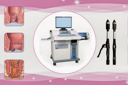 bệnh trĩ cấp độ 4 và cách điều trị